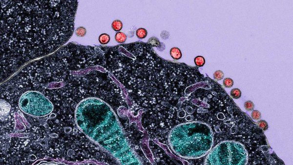 Electron micrograph of cells infected with HIV, demonstrating budding of the virus from the plasma membrane.