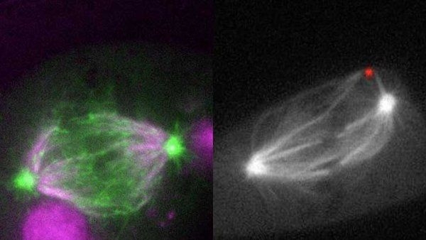 Microscopic image sof two cells dividing.