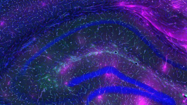 A microscopic image depicting higher amounts of pink dye that are not blocked by a blood-brain barrier in an aging brain.