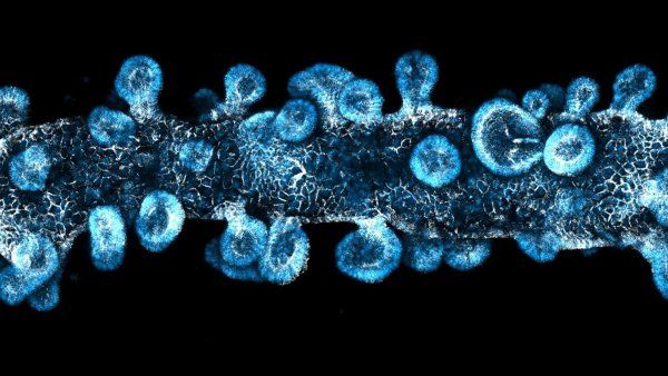 A fluorescent microscope image of a bioprinted intestinal organoid tube featuring blue stem cell markers and budding structures against a black background.