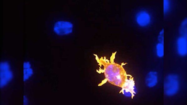 A fluorescent microscope image shows blue cell nuclei, green branching structures (likely microglia), and red/light blue clusters, possibly indicating plaques.