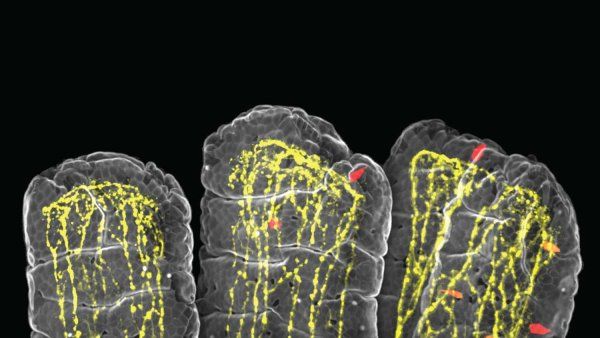 A microscopic image shows several finger-like structures called villi against a black background. The villi are filled with a glowing yellow network, and small, red almond-shaped cells—known as tuft cells—are scattered throughout the network.