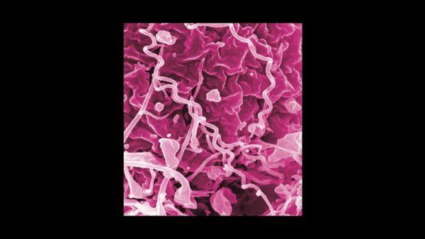 A microscopic image of Treponema pallidum, the bacteria that cause syphilis.