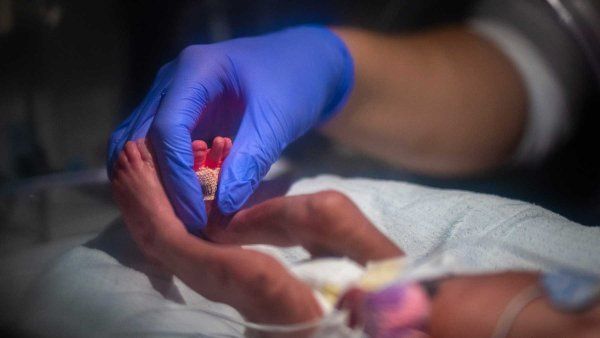A NICU nurse wears a blue latex glove as she soothes a premature baby at a neonatal intensive care unit.