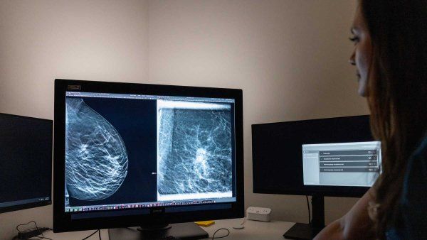 A medical practitioner looks at mammogram scans on a computer screen.