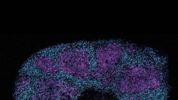 Microscopic image of a brain organoid showing magenta rings of progenitor cells surrounded by dense networks of cyan cortical neurons.