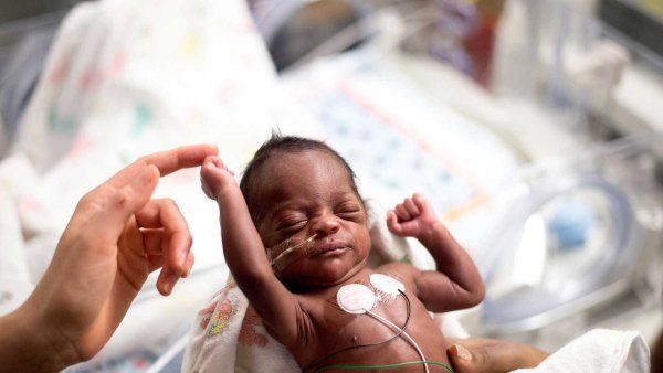 A preterm baby stretches his arm and touches a caretaker's finger.