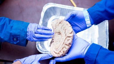 kids touch a human brain