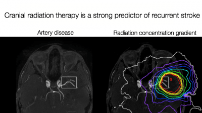 Radiation dose map_Release.png