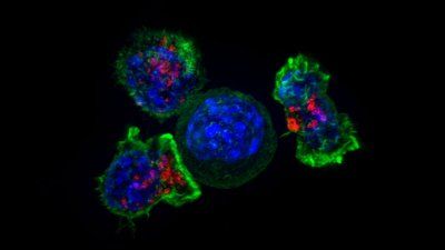 T-cells-NIH.jpg
