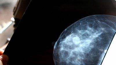 breast-scan.jpg