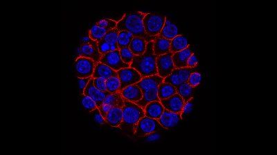 pancreatic-cancer-cells.jpg