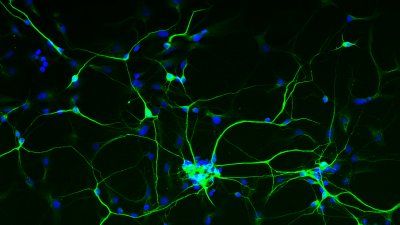 Science_in_Focus_Nurturing_Neurons.jpg