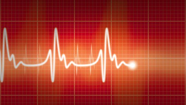 heart-EKG.jpg