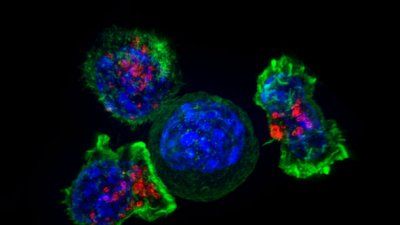 tcells-fighting-cancer.jpg