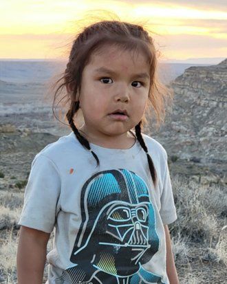 Hataalii Begay, age 4, the first child to receive the new stem cell treatment for Artemis-SCID