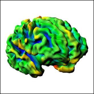 A 3D model of a baby's brain at a full term of 40 weeks of gestation.