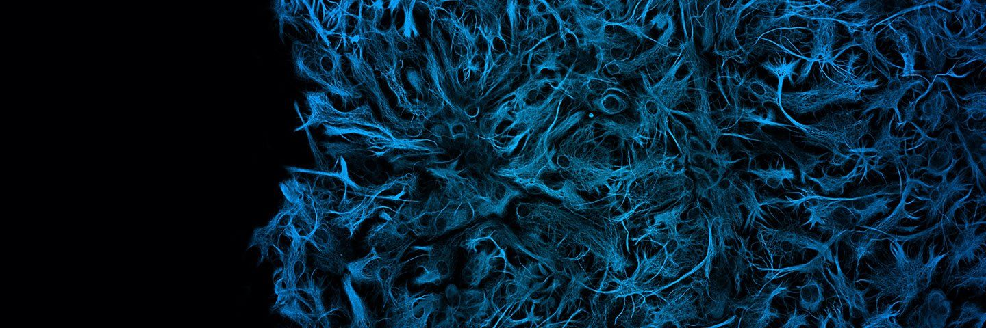 A web of blue neurons