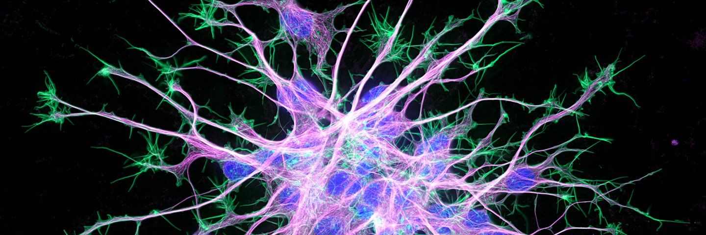A firework of purple neurons reaching out from a central point