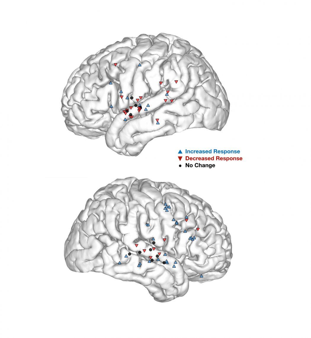 Maps showing how regions of the brain either have an increased response or decreased response 