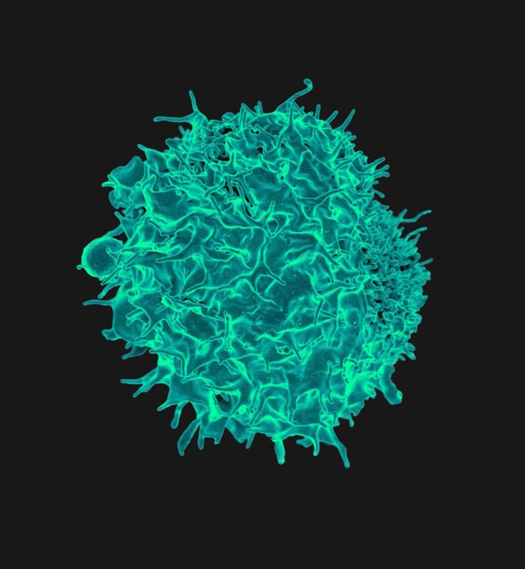 Colorized scanning electron micrograph of a T cell. The T cell is teal in color.   