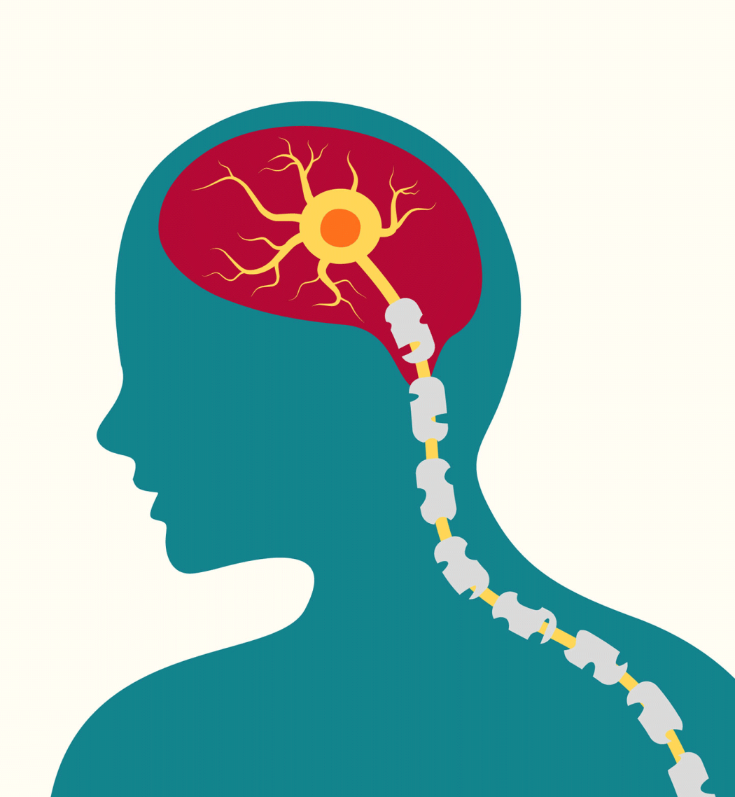 A graphic illustration of a silhouette featuring the spinal cord and a neuron in the brain. The illustration depicts mulitple sclerosis.