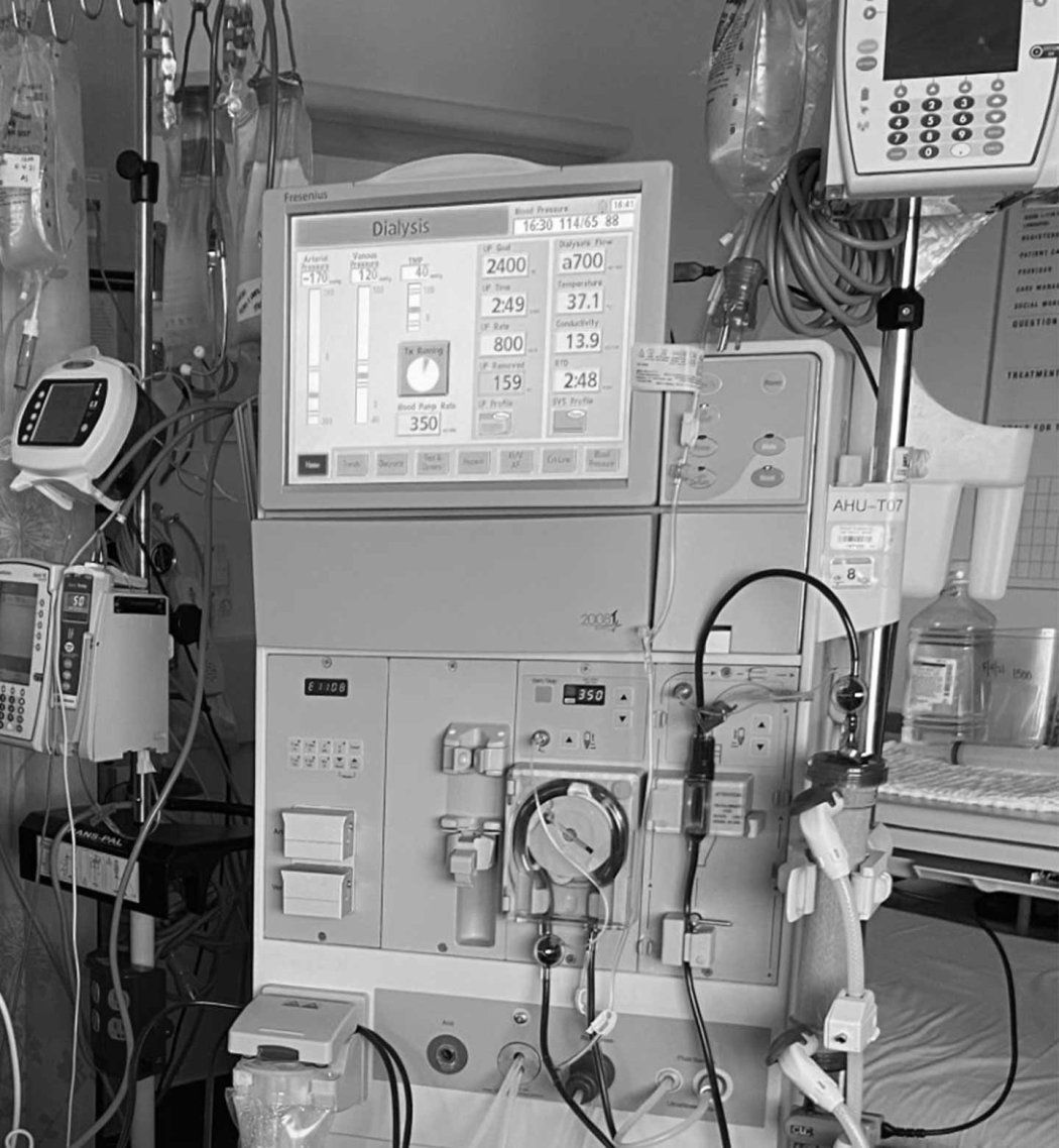 A dialysis machine in a hospital.