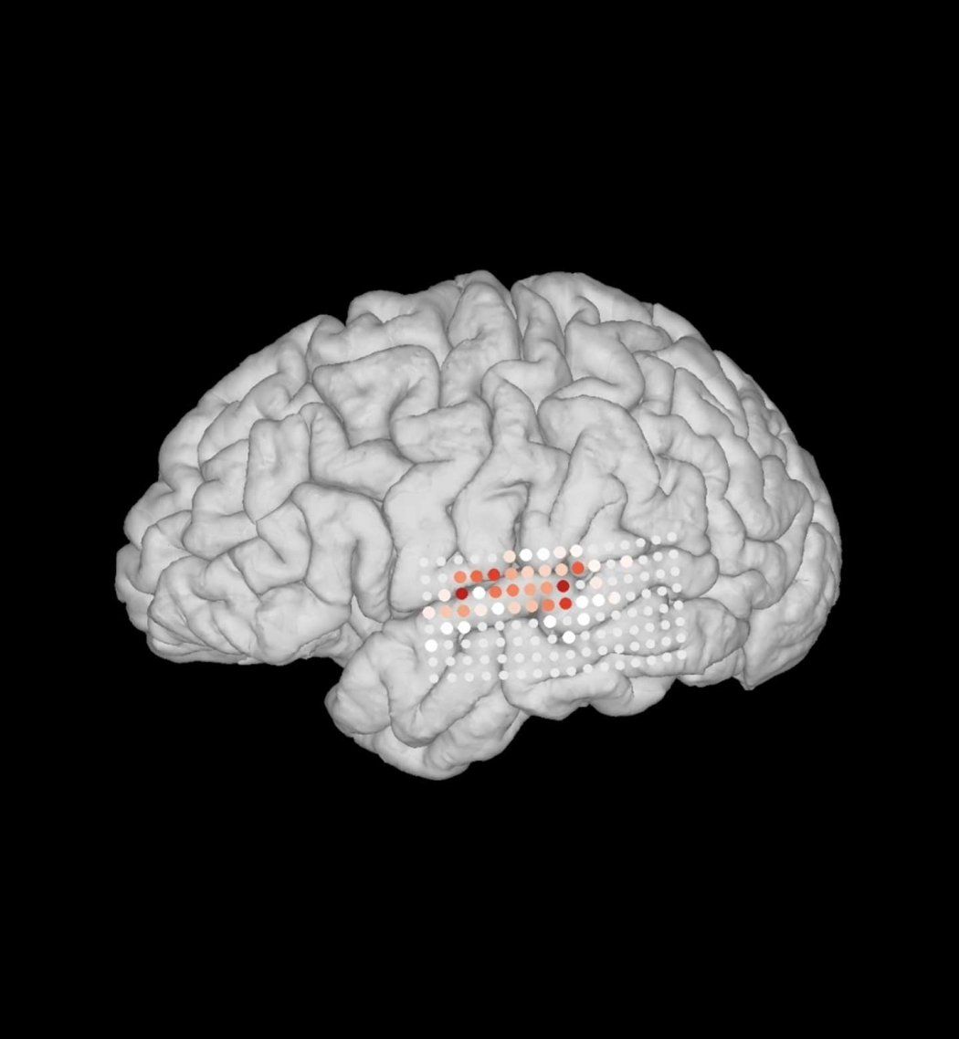 A scan of a brain showing activity in the auditory cortex during speech and music.