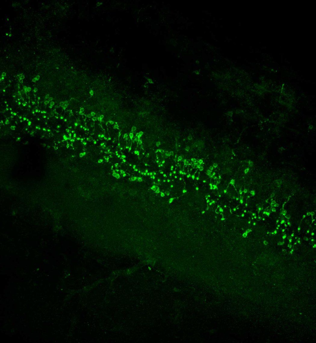 A microscopic image of cerebrospinal fluid-contacting neurons in a cross-sectional view of the spinal cord.