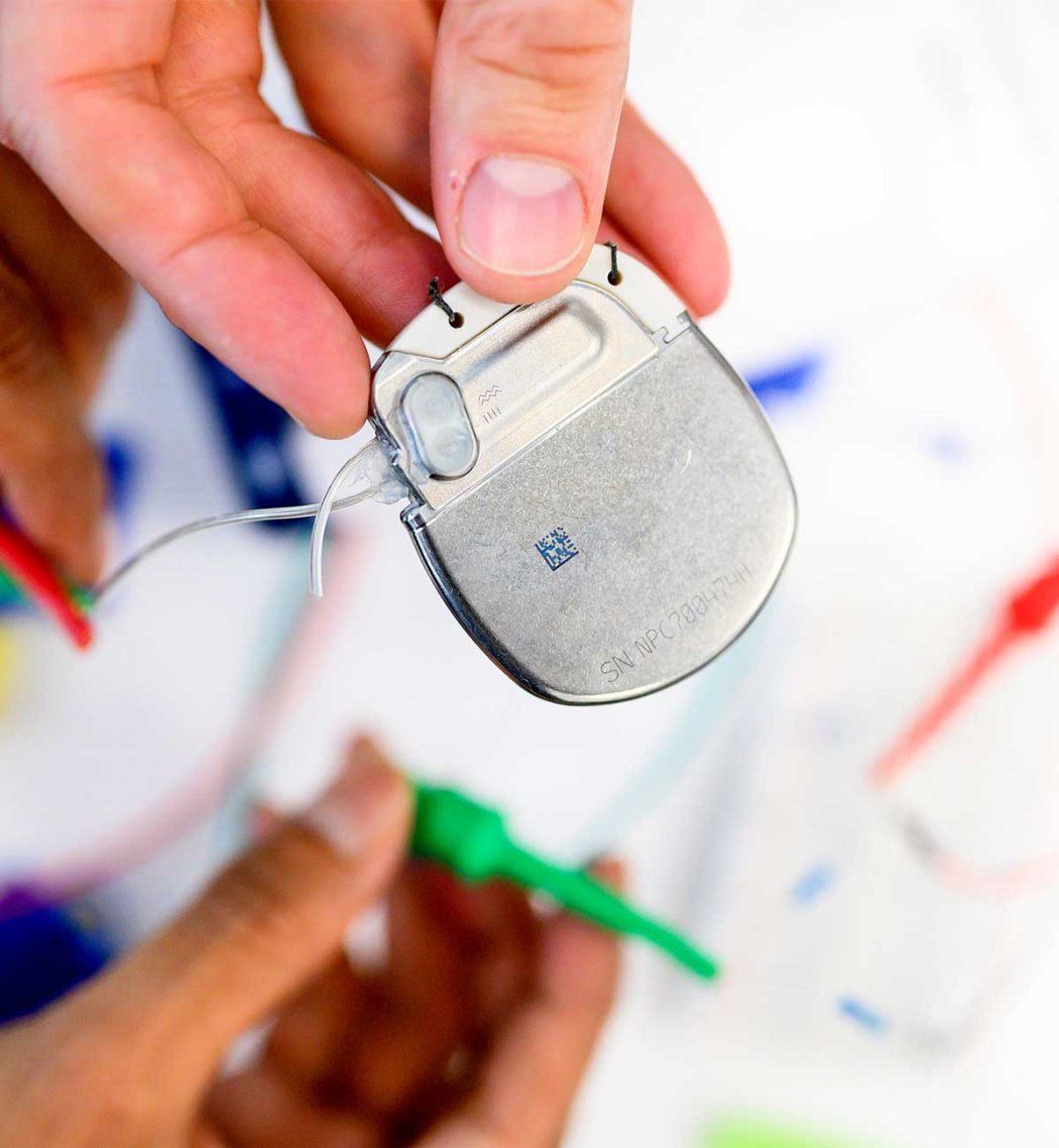 A hand holding wires and a deep brain stimulation device.