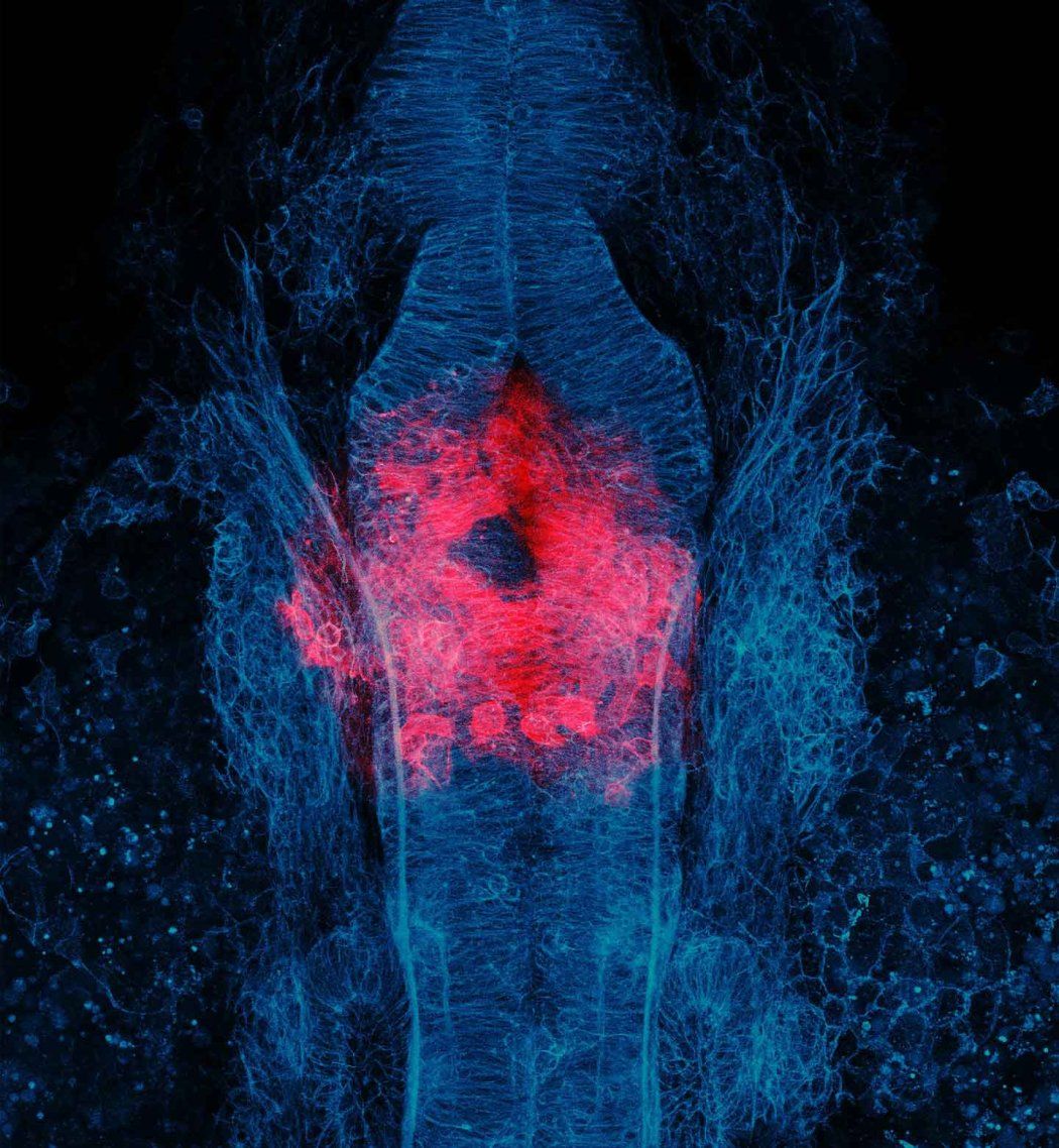 A dorsal view of a zebrafish embryo.