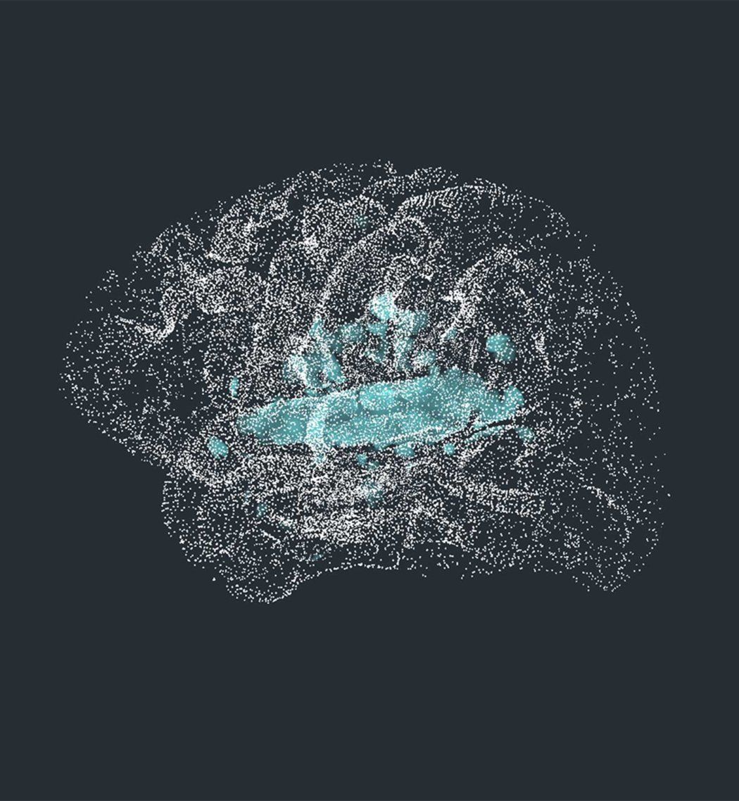 A representation of the brain highlighting the superior temporal gyrus (in blue), which helps us understand spoken language.