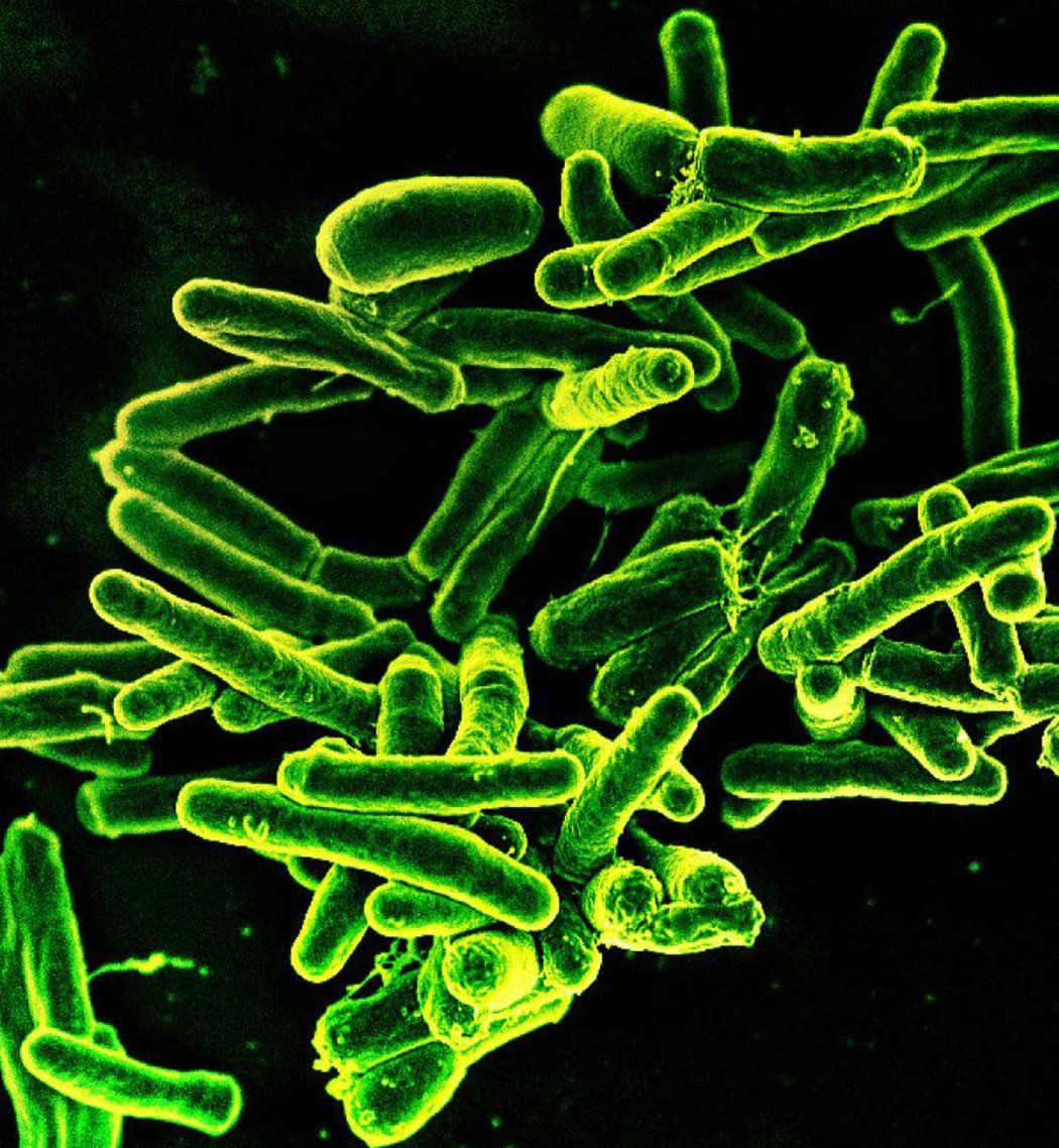 Scanning electron micrograph of Mycobacterium tuberculosis bacteria, which cause tuberculosis.