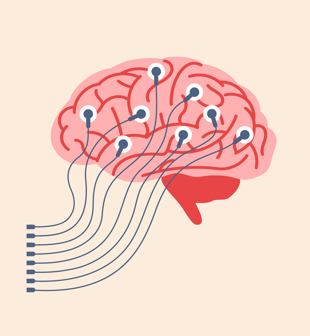 A conceptual illustration depicting wires hooked up to a brain that is under going an electroencephalogram (EEG).