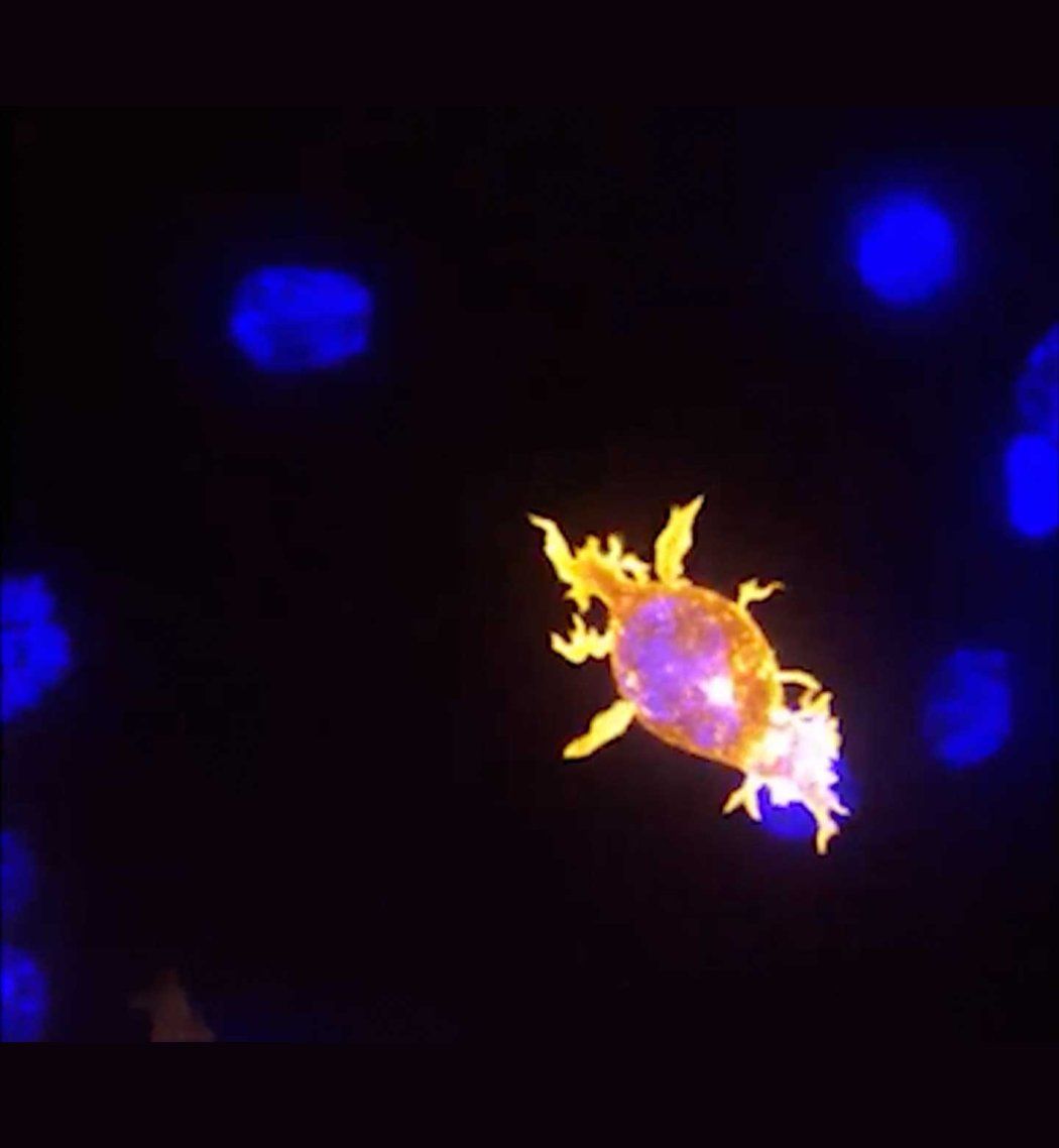 A fluorescent microscope image shows a glowing orange T cell with long, spiky extensions latching onto a purple-toned cancer cell. The interaction occurs against a dark background featuring several blurry blue orbs.