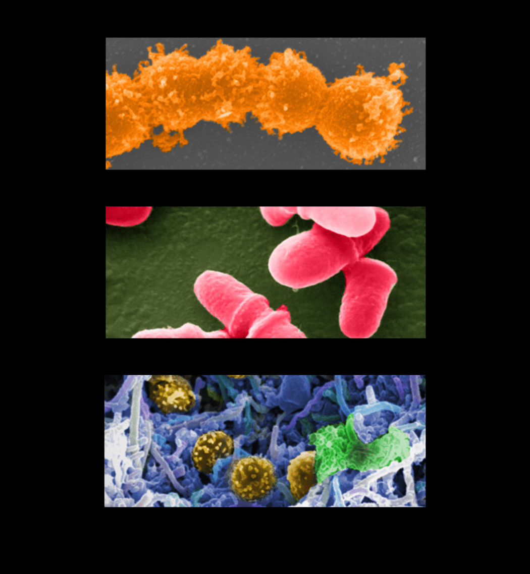 Microscopic visualization of diverse microbial life, featuring colorful, textured bacteria including red rod-shaped clusters, golden spheres, and purple filaments.