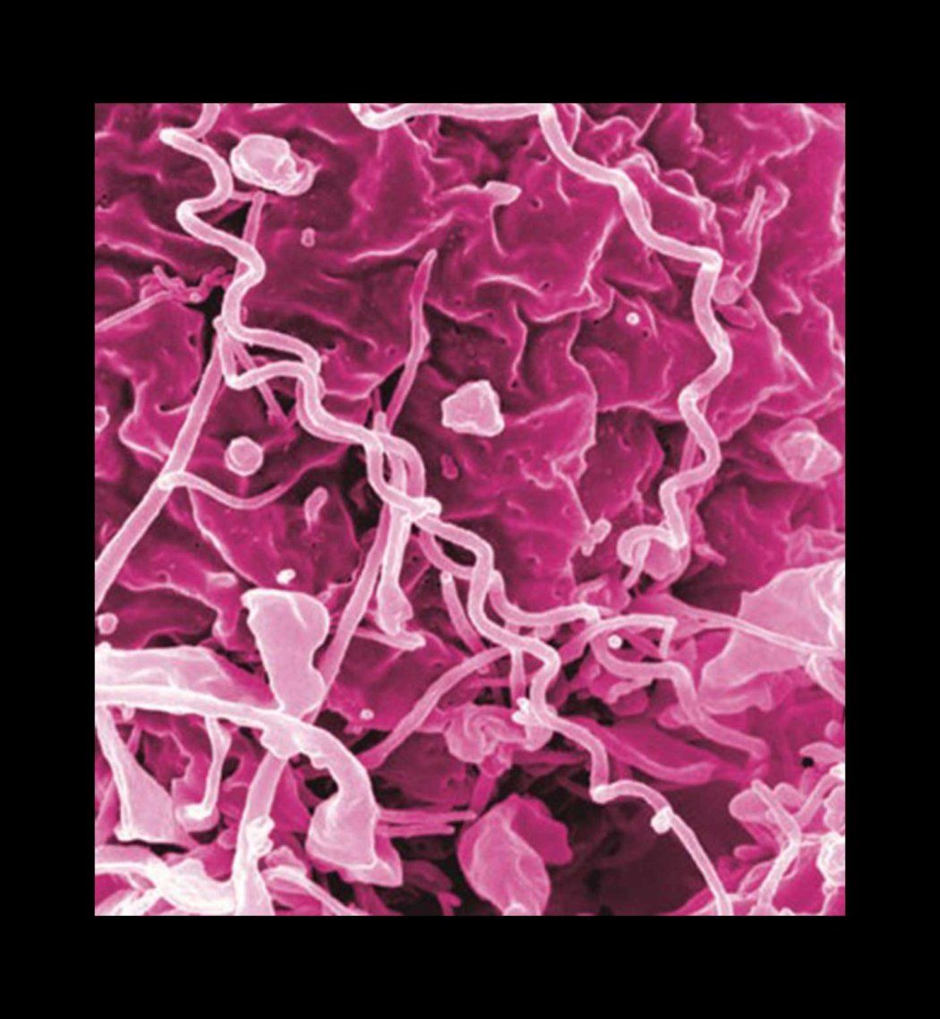 A microscopic image of Treponema pallidum, the bacteria that cause syphilis.