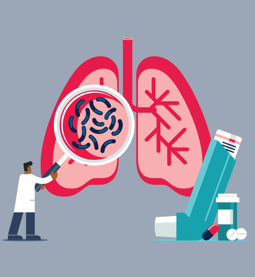 A graphic illustration depciting a doctor examining a pair of lungs with a magnifiying glass. Next to the lungs are an inhaller and medication in the form of pills, signifying treatment for asthma or C O P D.