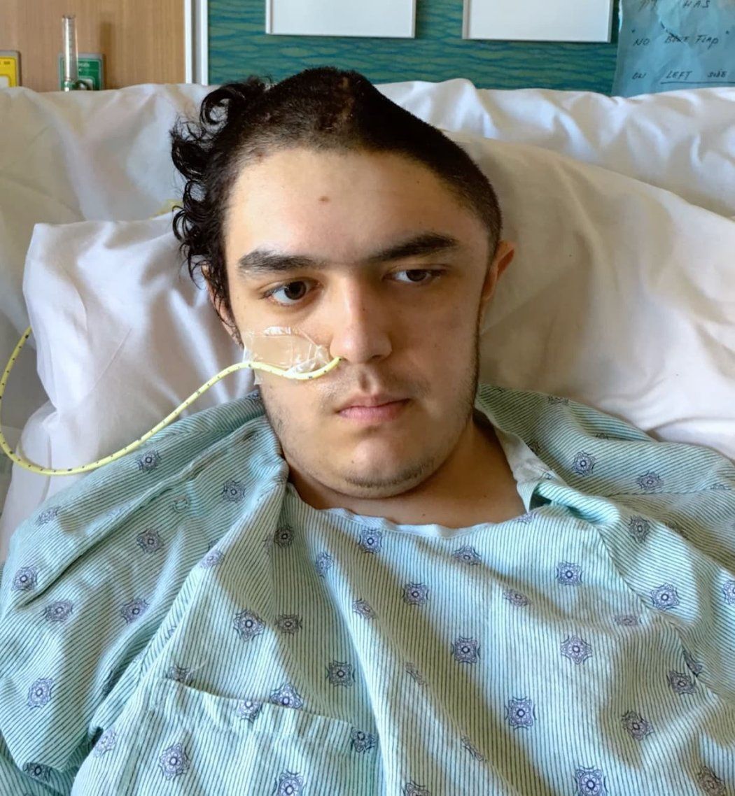 A young teenage boy lies in a hospital bed. Half his head is shaved after having brain surgery following a stroke.