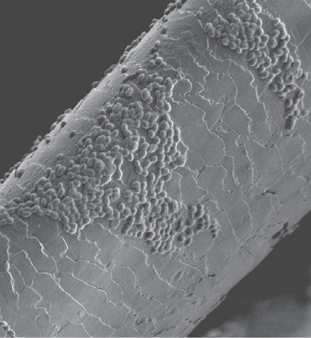 Scanning electron microscope image of Candida auris spores clustered on an infected hair follicle.