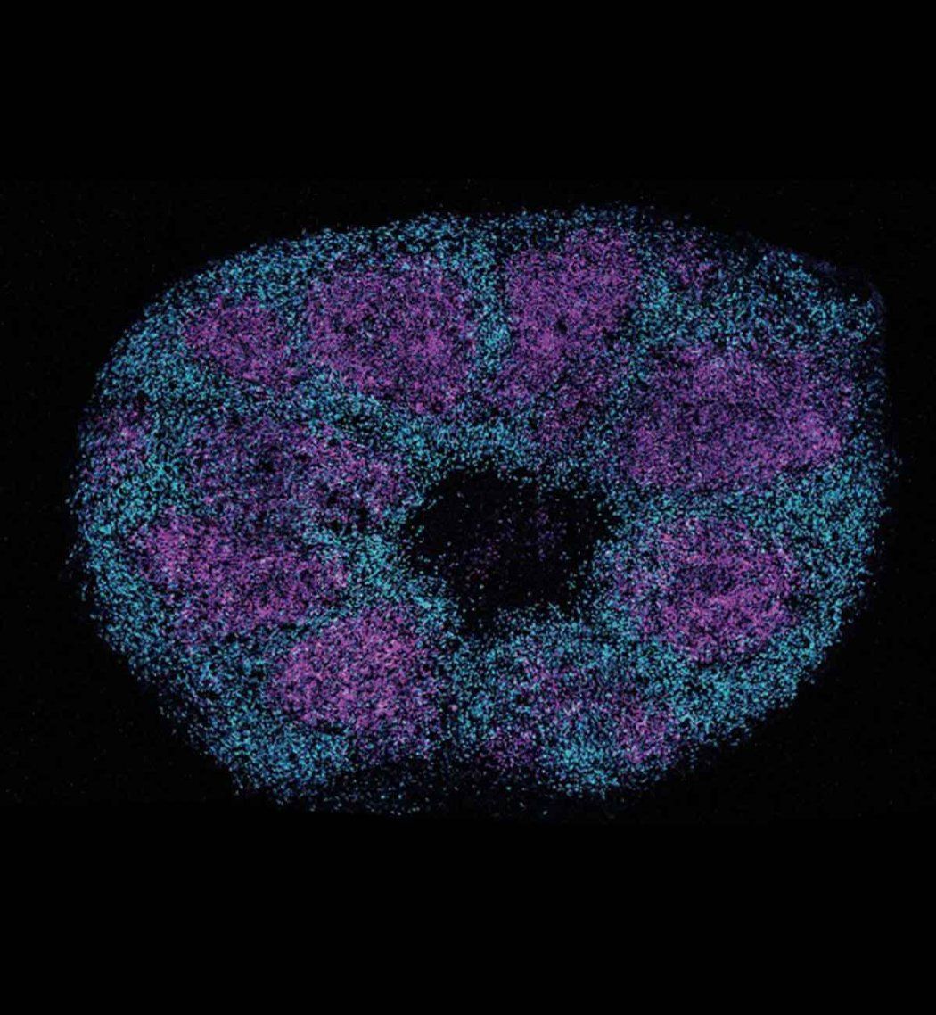Microscopic image of a brain organoid showing magenta rings of progenitor cells surrounded by dense networks of cyan cortical neurons.