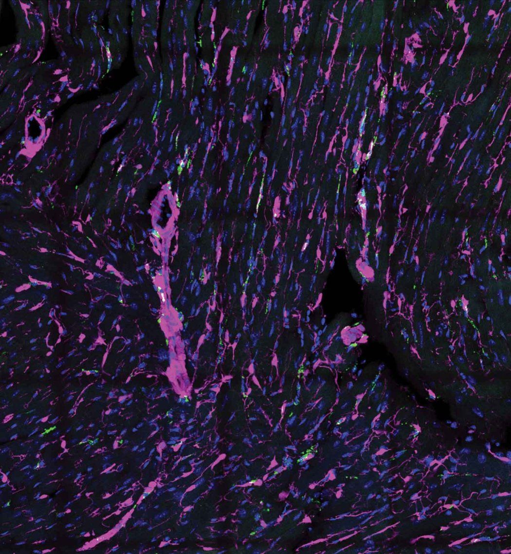Fluorescent microscopy image of heart muscle showing fibroblasts in magenta and macrophages in green.