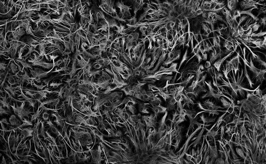 Microscopic image of astrocytes ensheathing embryonic neurons