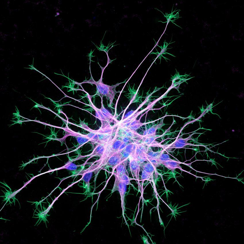 Microscopic image of neuron cytoskeleton
