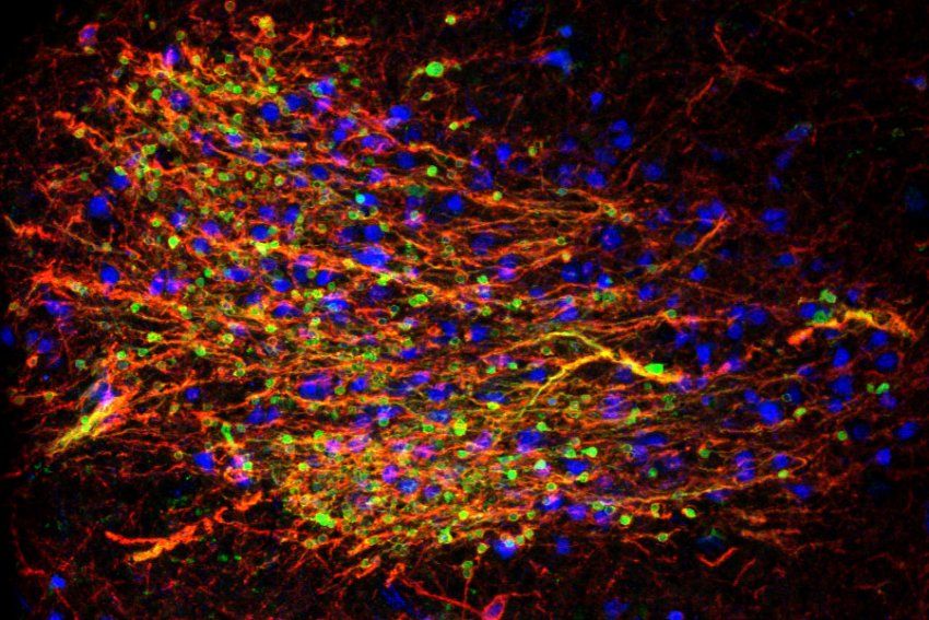 Immature amygdala neurons