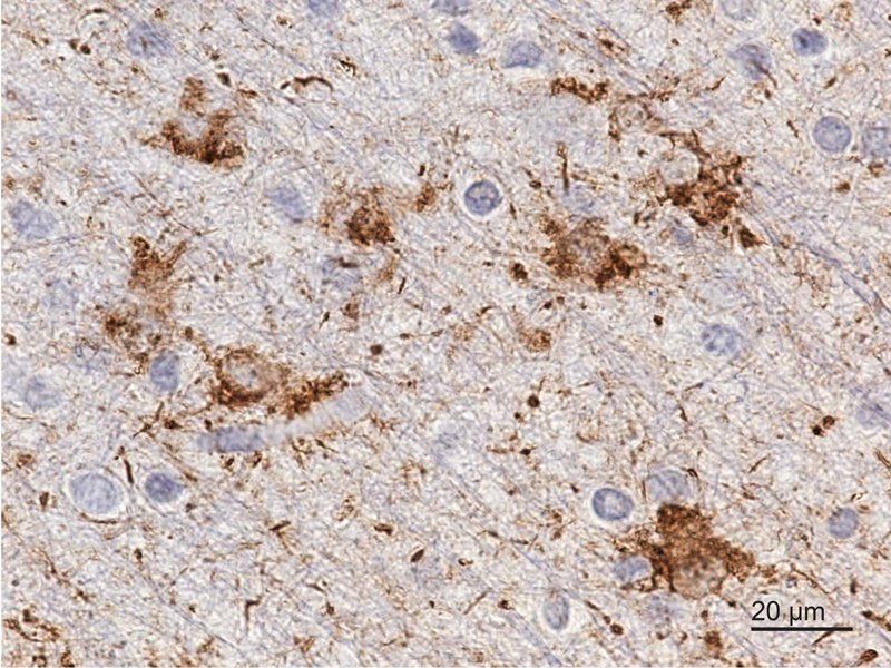 Microscopic image of brain cells.