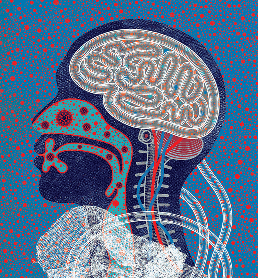 Illustration of the inside of a head, with                  coronavirus cells throughout the airways.